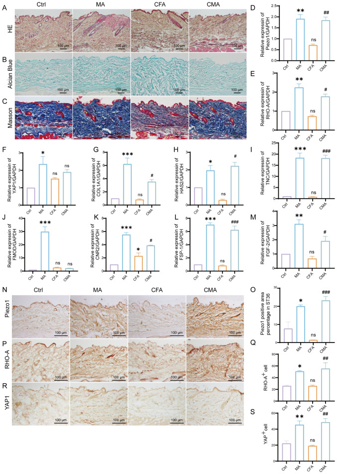 Scientific image with multiple panels showing histological and expression data comparisons across conditions labeled Ctrl, MA, CFA, and CMA. Panels A to C display histological staining using HE, Alcian Blue, and Masson techniques, each with a scale bar of one hundred micrometers. Panels D to I present bar graphs of various gene expressions relative to GAPDH, indicating statistical significance with asterisks and hash marks. Panels N to R illustrate immunohistochemical staining for Piezo1, RHO-A, and YAP1. Panels O, Q, and S feature bar graphs comparing positive cell counts or areas, with statistical markers.