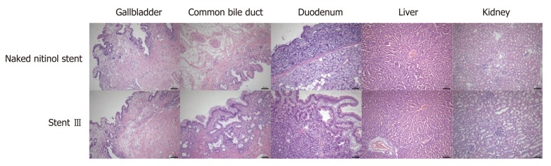 Pictures of hematoxylin and eosin staining of gallbladder, common bile duct, duodenum, liver, and kidney tissues after 30-d placement of naked fully covered self-expanding metal stent or Stent III in the porcine common bile duct (100-fold magnification).