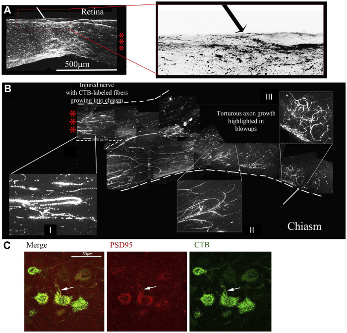 Four-drug treatment promotes robust axonal regeneration in the rat ONC model as detected by CTB-labelling. CTB labelling revealed a torturous pattern of growth from the site of the optic nerve crush (A) to the chiasm (B) of the same animal 7 days post CTB labelling. The three red asterisks between the retina with the crush site (A) to the chiasm (B) represent the same nerve without 6 mm of the nerve between, from 0.5 mm from the crush site to the chiasm. The red box is enlarged of the crush site in A and inverted to reveal the crushed regenerating axons. I and II display random processes and bifurcation of axons, a result of growth without guidance cues. III displays torturous axon growth further into the optic chiasm. (C) Regenerating axons reach the brain. Brain sections were immunostained for CTB, revealing CTB labeled neurons and fibers in the superior colliculus. CTB (green) and PSD95 (red) colocalize (yellow) in neurons in the superior colliculus, as highlighted by the white arrows.