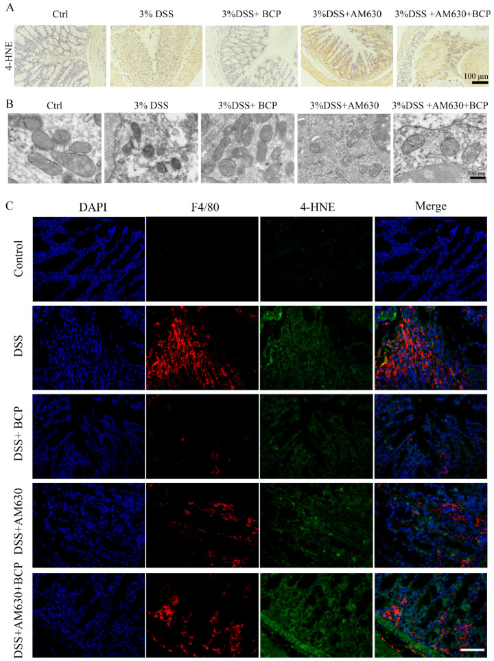 BCP ameliorates macrophage ferroptosis via activation of the CB2R in vivo (n = 6 in each group). (A), Representative images of immunohistochemical staining of colonic tissues for 4-HNE of colonic tissues. Scale bar, 100 μm. (B), Representative images of transmission electron microscopy of colonic tissues after different treatments. Scale bar, 500 nm. (C), Representative images of double immunofluorescence staining of colonic tissues for F4/80 and 4-HNE. Scale bar, 50 μm. 4-HNE, 4-hydroxynonenal; AM630, 6-Iodopravadoline; BCP, β-caryophyllene; DAPI, 2-(4-Amidinophenyl)-6-indolecarbamidine dihydrochloride; DSS, dextran sulfate sodium.