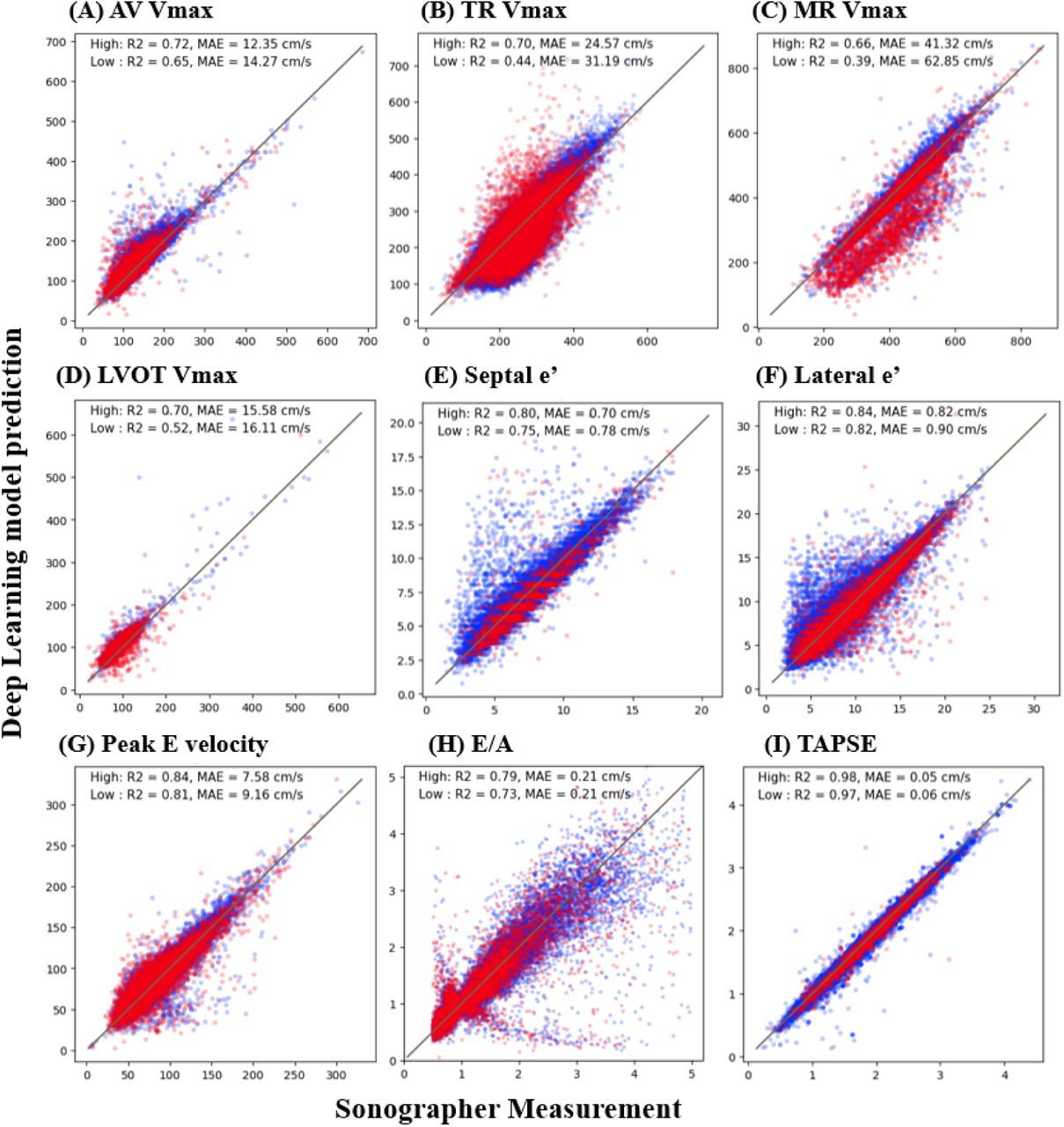 Correlation between Deep Learning Model and Sonographer Annotations for Echocardiographic Doppler Measurements Classified by Predicted Image-QualityScatterplot between deep learning model predictions and sonographer annotations for various echocardiographic Doppler measurements, classified by predicted image quality. Each plot represents a specific measurement, with the x-axis showing the values annotated by the sonographer and the y-axis showing the values predicted by the Deep Learning model. Blue indicates higher quality images predicted by image-quality model, and red indicates lower quality images predicted by the same model. The coefficient of determination (R2) and mean absolute error (MAE). For a detailed explanation of echocardiography parameter abbreviations, refer to Supplemental Table 1.
