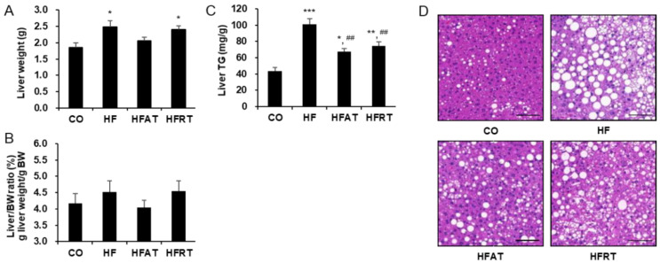 Changes in the liver weight, liver triglycerides (TG), and hepatic lipid droplet after exercise intervention. Changes in the liver weight (A), liver/BW ratio (B), liver TG levels (C), and hepatic lipid droplet (D) after exercise intervention are presented. Data are expressed as the mean ± standard error. CO, normal diet group; HF, high-fat diet (HFD) group; HFAT, HFD + aerobic training group; HFRT, HFD + resistance training group; BW, body weight; * p < 0.05, versus the CO group; ** p < 0.01, versus the CO group; *** p < 0.001, versus the CO group; ## p < 0.01, versus the HF group. Scale bar = 20 µm.
