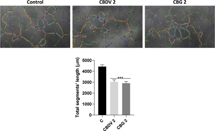 Impact of CBDV and CBG on tube formation by HTR-8/SVneo cells. Results are showed as the mean ± SEM of total segments’ length (µm) (n = 5). Legend: Red surrounded by blue—junctions; Segments—yellow; Branches—green; Meshes—cyan; Extremities—Orange; Artefactual branches—blue; Nodes—magenta. Significant differences between the control and CBDV and CBG are indicated by *** (p < 0.001)