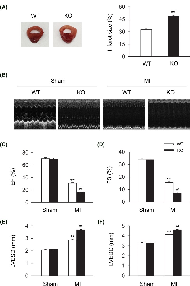 CB2R deficiency deteriorates MI severity and cardiac function in MI miceLeft anterior descending coronary artery was permanently occluded to create MI mice model. (A) Representative images of MI heart from WT and CB2R KO mice isolated at 24-h postinfarction. Quantitative analysis of the percentage of infarct size in heart issue (n=nine per group). **P<0.01 versus WT. (B) Representative images of 2D guided M-mode echocardiography at 4-week postinfarction. (C–F) Quantitative analysis of 2D guided M-mode echocardiographic detection including EF (%), FS (%), LVESD, and LVEDD at 4-week postinfarction (n=seven per group). **P<0.01 versus WT sham; ##P<0.01 versus WT MI.