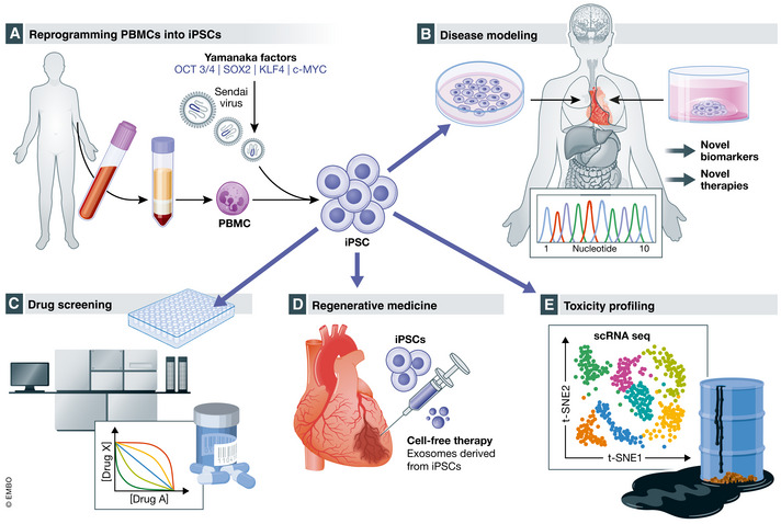 Applications for induced pluripotent stem cells (iPSCs) include disease modeling, drug screening, regenerative medicine, and toxicity profiling(A) From a single blood draw, peripheral blood mononuclear cells (PBMCs) are isolated and reprogrammed into iPSCs via viral transduction and overexpression of the Yamanaka factors (octamer‐binding protein 3/4 (OCT 3/4; also known as POU5F1), SRY (sex determining region Y)‐box 2 (SOX2), Krüppel‐like factor 4 (KLF4), and Myc proto‐oncogene protein (c‐MYC); Takahashi & Yamanaka, 2006; Takahashi et al, 2007; Yu et al, 2007). (B) iPSCs contain an individual's genetic information, and disease modeling offers the unique opportunity to understand patient‐specific disease mechanisms that might lead to novel biomarkers and therapies. (C) Drug screening traditionally has difficulty translating from small animal and cell culture models to the clinic. iPSCs contain the genetic code of individuals and can be differentiated into any cell type allowing the determination of safety, efficacy, and possibly patient‐specific responses in a dish. (D) Regenerative medicine involves iPSCs and cell‐free therapy with exosomes derived from iPSCs. (E) iPSCs are also ideally suited to testing for the effects of toxins on the different tissue beds and identifying patient‐specific factors that predispose to toxicity. [Colour figure can be viewed at wileyonlinelibrary.com]
