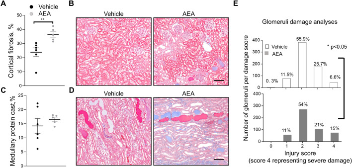 Development of the kidney injury after chronic exposure to a high dose of AEA (3 mg/kg) in Dahl SS rats. (A, C) Summary graphs of the cortical fibrosis (A) and medullary protein cast area (percent total kidney area; C). Protein cast analysis was performed using a color thresholding method using Metamorph software. Fibrosis was assessed using color deconvolution in the Fiji image application (ImageJ 1.47v, NIH). Data were analyzed using one-way ANOVA followed by Holm-Sidak post hoc test. (B, D) Representative images of cortical and medullary kidney tissue stained with Masson’s trichrome (× 10 magnification). Scale bar is 150 µm. *P < 0.05. (E) Glomerular injury score assessed by semiquantitative morphometric analysis. Numbers of glomeruli per score are shown on the y-axes. The percentage of glomeruli within the selected score range defined from cumulative distribution is shown above the corresponding column. Note the difference between the groups within the damage score 4. n ≥ 5 rats per group, N ≥ 500 glomeruli per group. A Kolmogorov–Smirnov test was used to identify significant differences between the groups (OriginPro 9.0) with a P < 0.05, distributions were significantly different.