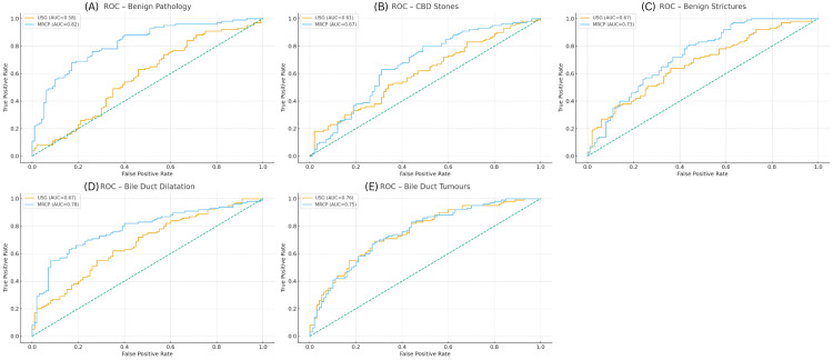 ROC curves of USG and MRCP across major biliary pathologiesROC curves comparing the diagnostic performance of USG and MRCP for six major biliary pathologies: (A) Benign pathology, (B) CBD stones, (C) benign strictures, (D) bile duct dilatation, (E) bile duct tumors, and (F) overall diagnostic accuracy. For each pathology, the true positive rate (sensitivity) is plotted against the false positive rate (1–specificity). The AUC for USG and MRCP is indicated in the legend of each panel. The diagonal dashed line represents the reference line for random classifier performance. MRCP consistently demonstrates higher AUC values than USG across most categories, indicating superior diagnostic accuracy for detecting biliary abnormalities.AUC, area under the curve; CBD, common bile duct; MRCP, magnetic resonance cholangiopancreatography; ROC, receiver operating characteristic; USG, ultrasonography.