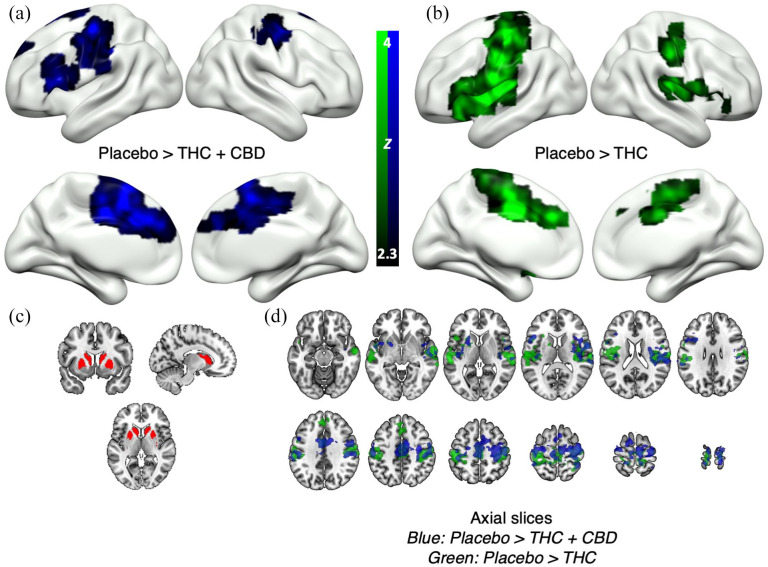 Drug effects on brain-wide connectivity with the associative striatum in Study 1. Contrasts are placebo > active drug. Clusters represent a significant decrease in functional connectivity with the associative striatum in the active drug conditions. (a) Significant clusters (blue) in the placebo > THC + CBD comparison on 3D cortical renders. (b) Significant clusters (green) in the placebo > THC comparison on 3D cortical renders. (c) The associative striatum seed-region. (d) Significant clusters in both comparisons ((a) and (b); same colours) overlaid together on axial slices.