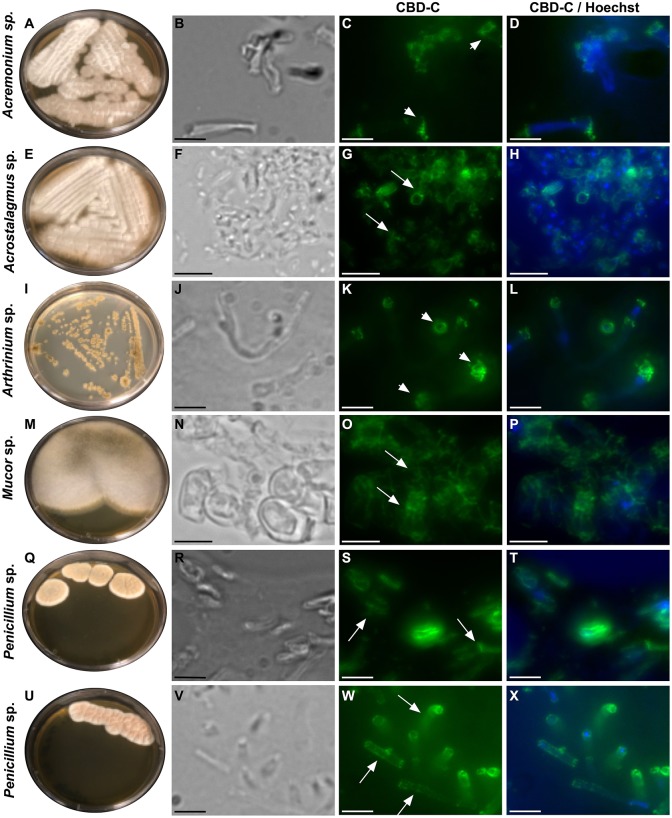 Immunofluorescence with the Fc-CBD-C probe on fungal sections. Several species of fungi, including: Acremonium sp., Acrostalagmus sp., Arthrinium sp., Mucor sp., and Penicillium spp., were isolated from Ciona gut and grown on YPD agar plates (A,E,I,M,Q,U). Immunofluorescence staining, using the Fc-CBD-C probe and detected with a fluorescent secondary antibody (Alexa Fluor 488), on OCT-embedded and cryo-sectioned fungal isolates, indicates that chitin molecules are distributed in the whole cell wall of most of the fungi analyzed (G,O,S,W, arrows). In two fungal species, the Fc-CBD-C probe detects chitin localized in specific regions of the fungal cell wall (C,K, arrowhead). (B,F,J,N,R,V) are brightfield images of fungal sections; (D,H,L,P,T,X) represents merged images of the Fc-CBD-C probe (green) and nuclear staining with Hoechst (blue). Scale bars: (B–D,J–L,R-T,V–X), 5 μm; (F–H, N–P) 10 μm.