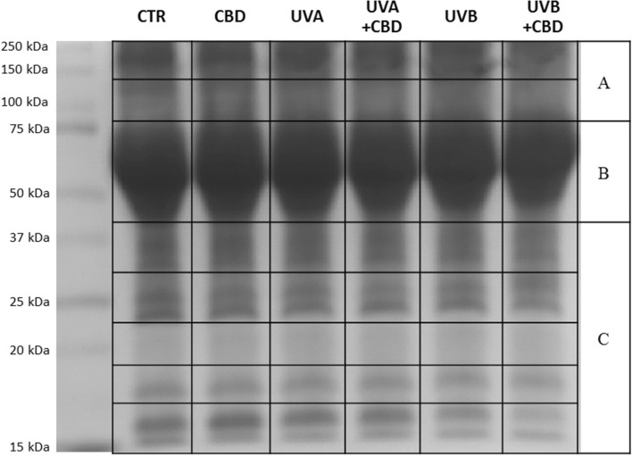 SDS-PAGE separation and staining with Coomassie Brilliant Blue R-250 of plasma proteins from the control rats (CTR) and animals topically treated with cannabidiol (2.5 g CBD in 100 g petrolatum) and/or irradiated with UVA (increasing doses from 0.5 to 5 J/cm2) or UVB (increasing doses from 0.02 to 2 J/cm2). (A–C) Protein pooling sections for proteomic analyzes.