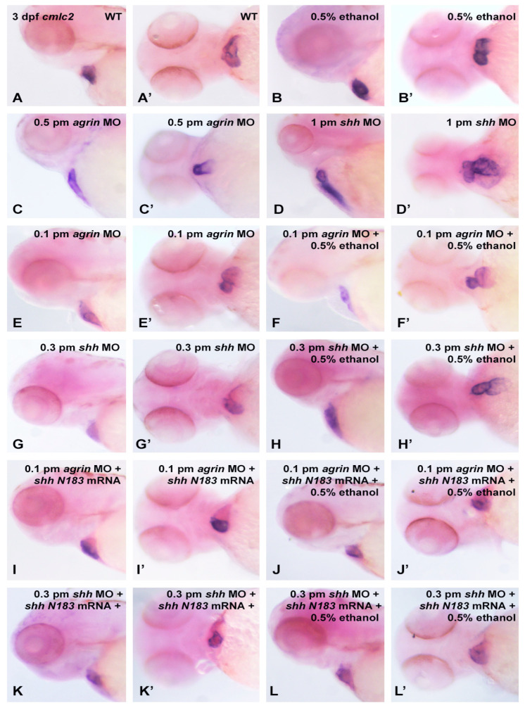 Cmlc2 mRNA expression in 3 dpf zebrafish heart following MO and EtOH treatments. Ventral and lateral views of embryos are shown. (A,A’), wild-type; (B,B’), 0.5% EtOH exposure from 3–24 hpf; (C,C’), 0.5 pmol agrin MO injection of embryos; (D,D’), 1 pmol shh MO injection of embryos; (E,E’) 0.1 pmol agrin MO injection; (F,F’), 0.1 pmol agrin MO combined with 0.5% EtOH exposure; (G,G’), 0.3 pmol shh MO injection; (H,H’), 0.3 pmol shh MO combined with 0.5% EtOH; (I,I’), 0.1 pmol agrin MO and 25 pg shhN183 mRNA injection of embryos; (J,J’), 25 pg shhN183 mRNA injection rescues cmlc2 expression pattern in embryos treated with 0.1 pmol agrin MO and 0.5% EtOH; (K,K’) 0.3 pmol shh MO and 25 pg shhN183 mRNA injection of embryos; (L,L’), 25 pg shhN183 mRNA injection rescues cmlc2 expression pattern in embryos treated with 0.3 pmol shh MO and 0.5% EtOH.