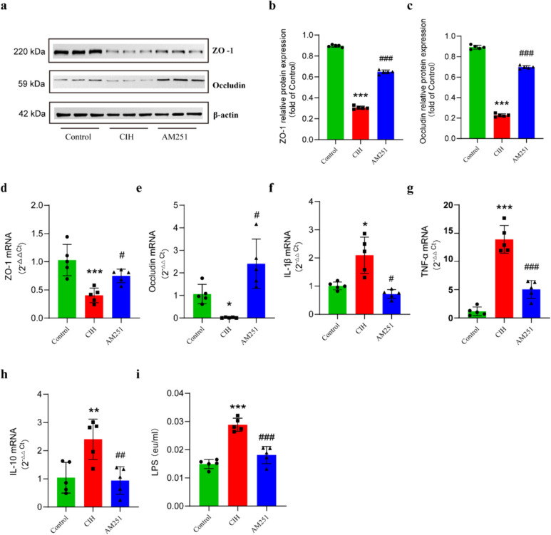 Inhibition of CB1 receptor promotes the production of intestinal tight junction proteins under CIH conditions and reduces intestinal inflammation and metabolic endotoxemia. a–c Western blot to detect the expression of ZO-1 and Occludin in colon. d, e RT-PCR to detect the mRNA expression of ZO-1 and Occludin in colon. f–h RT-PCR to detect IL-1β (f), TNF-α (g), and IL-10 mRNA (h). i Serum LPS level detected by ELISA (eu, ELISA units). *P < 0.05, **P < 0.01, compared to the Control group; #P < 0.05, ##P < 0.01, compared to the CIH group