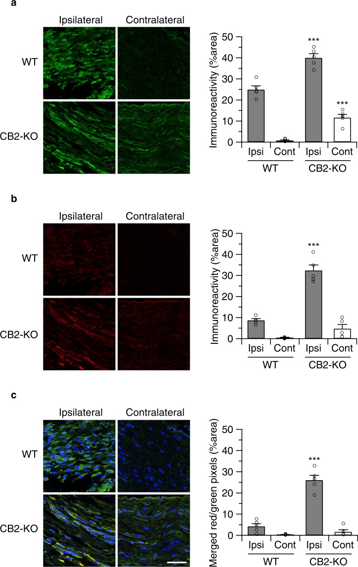 CB2-KO mice show enhanced nerve injury-induced macrophage recruitment in peripheral nerves. Shown are immunostaining nerve tissues with F4/80 (a) and leptin receptor (b) 14 days after the surgery. Bars indicate a length of 100 μm, except for bars on close-up image indicating a length of 50 μm. Merged image (c) show that leptin receptor signals overlap with F4/80 signals,indicating infiltrated macrophages were expressing leptin receptors in CB2-KO mice. Quantified immunoreactivity is expressed as percentage of positive signals to the stained area (mean ± SEM). A significant genotype effect is indicated by ***p < 0.001, compared with respective WT controls (two-way ANOVA followed by Sidak’s multiple comparisons test), n = 5.