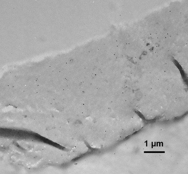 Electron microscopy image of immunolabelling of CBD-treated Whatman CF11 fibres.