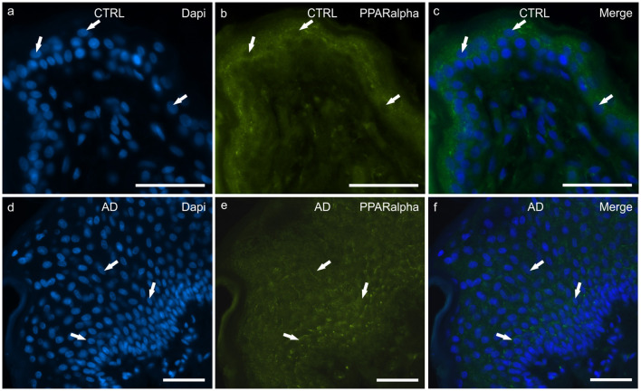 Photomicrographs of cryosections of canine skin showing peroxisome proliferator-activated receptors alpha (PPARα) immunoreactivity (IR) in the tissues of the healthy dogs (CTRL) (a–c) and in the dogs with atopic dermatitis (AD) (d–f). (a–c) The arrows indicate the DAPI-labeled nuclei of some keratinocytes showing moderate cytoplasmic PPARα-IR. (d–f) The arrows indicate the DAPI-labeled nuclei of some keratinocytes showing moderate cytoplasmic PPARα-IR in the cells of the basal and the suprabasal layers. Bar, 50 μm.