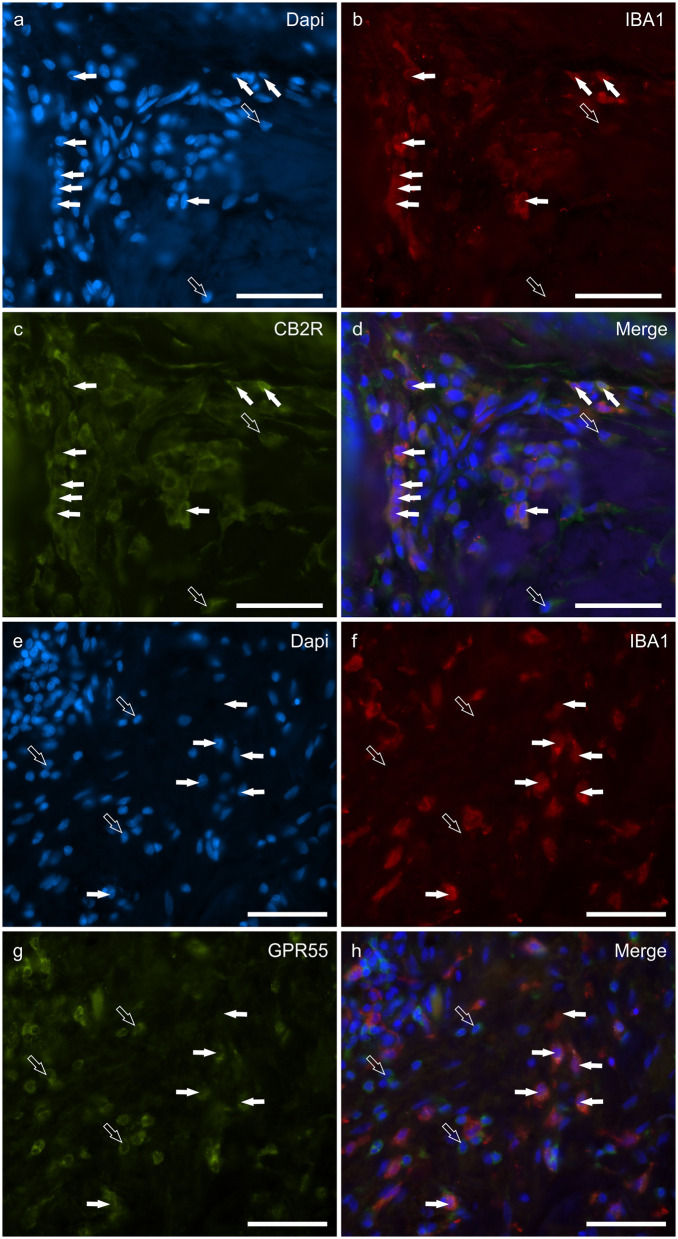 Photomicrographs of the cryosections of the skin of dogs with atopic dermatitis (AD) showing IBA1 immunoreactive cells (macrophages and dendritic cells) expressing cannabinoid receptor 2 (CB2R) (a–d) and G-protein coupled receptor 55 (GPR55) (e–h) immunoreactivity (IR). The white arrows indicate the Dapi-labeled nuclei of IBA1 positive cells co-expressing CB2R- (c) and GPR55-IR (g). The open arrows indicate some IBA1 negative cells of the dermis which expressed CB2R- (c) and GPR55-IR (g). Bar: 50 μm.