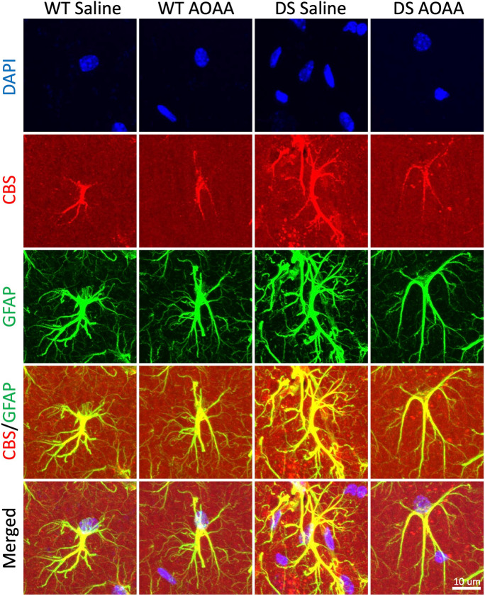 Reactive astrogliosis in DS brains. Representative zoom-in images of astrocytes (GFAP, green) and CBS (red) and merged images with DAPI (blue) are shown. CBS was found mostly in the astrocytes, but it was also present in vascular tissues surrounded by astrocytic end-feet. DS was associated with reactive astrogliosis, as evidenced by higher astrocyte numbers, larger astrocyte cell size, and more complex branching