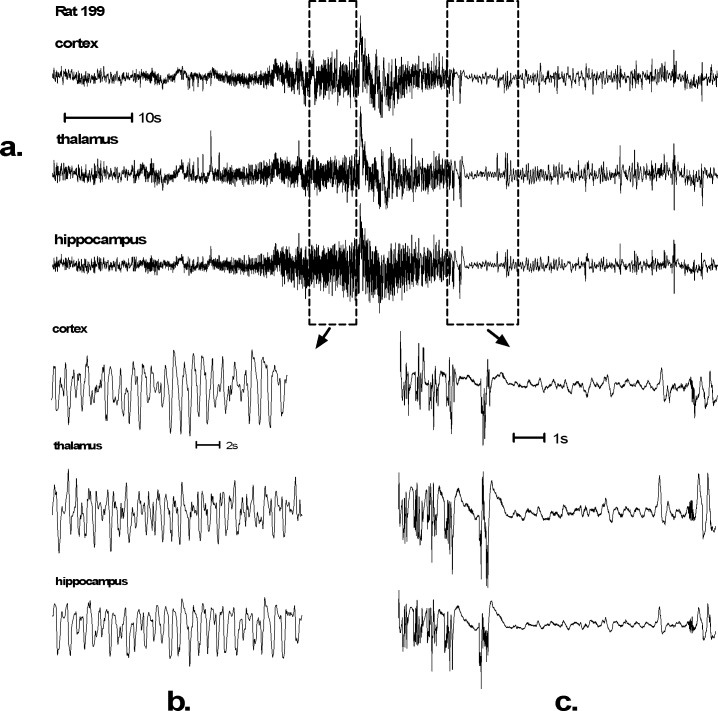 EEG recording of an SLV326 induced convulsive seizure.Such generalized seizures were found in 6 out of 24 Wistar rats treated with SLV326. Control animals were seizure free. Seizures typically start with low amplitude spikes that gradually increase in amplitude. The duration of this seizure (a.) is 30 seconds. High amplitude spike activity can be seen during the whole seizure (b.). The seizures of 3 out of 6 animals were followed by a postictal depression (c.). Behaviorally this EEG corresponds with severe tonic-clonic convulsions, Racine scale 5 (S1 File).