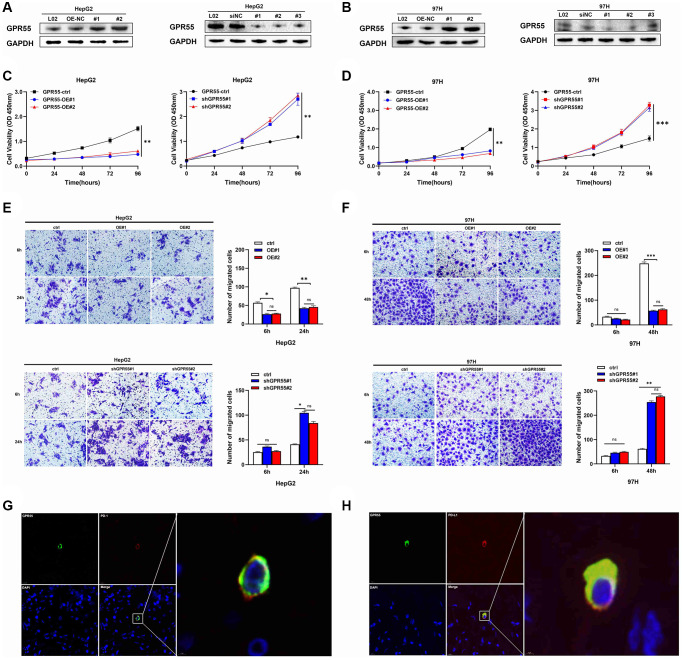 (A) Protein levels of GPR55 were detected by western-blotting in HepG2 cells, respectively. (B) Protein levels of GPR55 were detected by western-blotting in 97H cells, respectively. (C) Determination of cell viability in HepG2 cells. (D) Determination of cell viability in 97H cells. (E) Transwell assay in HepG2 cells. (F) Transwell assay in 97H cells. (G) Immunofluorescence staining of GPR55 and PD-1. (H) Immunofluorescence staining of GPR55 and PD-L1. N = 3, ***P < 0.01, t-test.