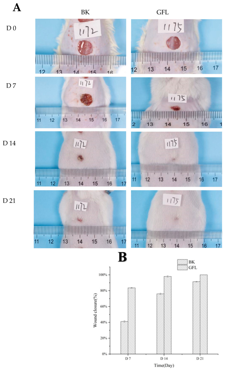 Wound healing photographs (A) and healing area (B) of GFL. Tgf-β1 (C) and VGEF (D) expression in the GFL model at 14 days.