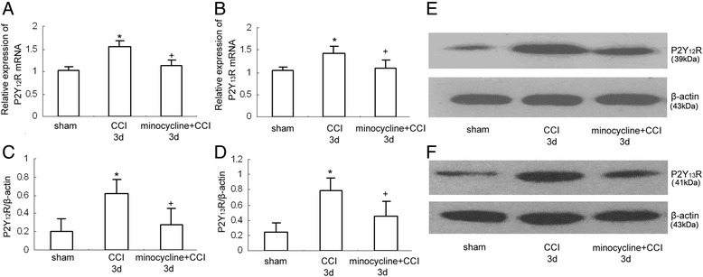 The effect of minocycline on the expression of P2Y12 and P2Y13 receptors. All values represent mean ± standard deviation. a RT-PCR results show the expression of P2Y12 mRNA expression in the rat dorsal spinal cord (n = 8 per group). *P < 0.05 means comparison with the sham group; + P < 0.05 means comparison with the CCI rats. b RT-PCR results show the expression of P2Y13 mRNA expression in the rat dorsal spinal cord (n = 8 per group). *P < 0.05 means comparison with the sham group; + P < 0.05 means comparison with the CCI rats. c Western blotting quantitative analysis of the P2Y12R expression in the rat dorsal spinal cord. *P < 0.05 means comparison with the control; + P < 0.05 means comparison with the ADPbetaS-treated rats. d Western blotting quantitative analysis of the P2Y13R expression in the rat dorsal spinal cord. *P < 0.05 means comparison with the control; + P < 0.05 means comparison with the ADPbetaS-treated rats. e Western blotting image of P2Y12R expression. The top panel was the target band, P2Y12R, and the bottom one was for the loading control beta-actin. f Western blotting image of P2Y13R expression. The top panel was the target band, P2Y13R, and the bottom one was for the loading control beta-actin