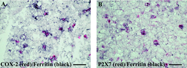 Co-localisation studies of COX-2 and P2X7 in ALS spinal cord. Double staining of COX-2 or P2X7 cells with ferritin (microglia marker) in ALS spinal cord. Section incubated with mixture of A) ferritin (black) and COX-2 (red) antibodies or B) ferritin (black) and P2X7 (red). All COX-2 or P2X7 immunoreactive cells are microglial cells/macrophages, scale bars = 100 μm.