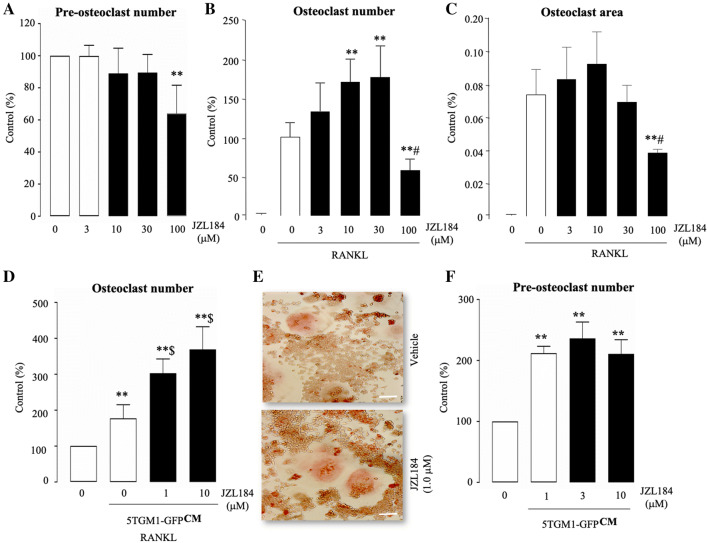 JZL184 enhances RANKL and MM-induced osteoclast formation. a In vitro cell viability and survival of mouse RAW 264.7 macrophage (pre-osteoclasts) treated with vehicle or JZL184 (0–100 μM) for 6 days, as assessed by AlamarBlue assay. b In vitro number of multi-nucleated osteoclasts with 3 or more nuclei in cultures of RANKL (100 ng/ml)-stimulated mouse RAW 264.7 mature osteoclasts treated with vehicle or JZL184 (0–100 μM) for 6 days as visualised by TRAcP staining. c Area of TRAcP positive osteoclasts in cultures of RANKL (100 ng/ml)-stimulated osteoclasts in mouse RAW 264.7 cultures treated with vehicle or JZL184 (0 –100 μM) for 6 days as measured by ImageJ. d In vitro multi-nucleated osteoclast number in cultures of RANKL-stimulated mouse RAW 264.7 pre-osteoclasts treated with vehicle or JZL184 (0–10 μM) for 7 days in the presence and absence of conditioned medium from 5TGM1-GFP MM cells (CM, 10% v/v), as visualised by TRAcP staining. e Representative photomicrographs of multi-nucleated osteoclasts from the experiment described in panel d. f In vitro viability and survival of osteoclast precursors in the experiment described in panels d and e, as assessed by AlamarBlue assay. Values are mean ± SD: **p < 0.01 from vehicle; # p < 0.05 from other JZL184 treated cultures; $ p < 0.05 from vehicle plus 5TGM1-GFP conditioned medium