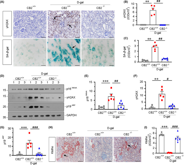 CB2 gene ablation ameliorates kidney ageing. (A) Representative micrographs showing renal expression of γH2AX and SA‐β‐gal activity in different groups. Paraffin‐embedded kidney sections were immunostained with an antibody against γH2AX (top). Frozen kidney sections were stained for SA‐β‐gal activity (bottom). Arrows indicate positive staining. Scale bar, 50 μm. (B‐C) Quantitative data showing quantification of positive staining. **p < 0.01 versus WT mice group alone; ## p < 0.01 versus the d‐gal‐treated WT mice group alone (n = 5–6). (D–G) Representative Western blot and quantitative data showing renal expression of p16INK4A, γH2AX and p19ARF in different groups. Numbers (1–3) indicate each individual animal in a given group. **p < 0.01, ***p < 0.001 versus the WT mice group alone; # p < 0.05, ## p < 0.01, ### p < 0.001 versus the d‐gal‐treated WT mice group alone (n = 5–6). (H and I) Representative micrographs showing renal expression of klotho in different groups (H). Paraffin‐embedded kidney sections were immunostained with an antibody against klotho. Arrows indicate positive staining. Scale bar, 50 μm. (I) Quantitative data showing quantification of positive staining. ***p < 0.001 versus the WT mice group alone; ### p < 0.001 versus the d‐gal‐treated WT mice group alone (n = 5–6)