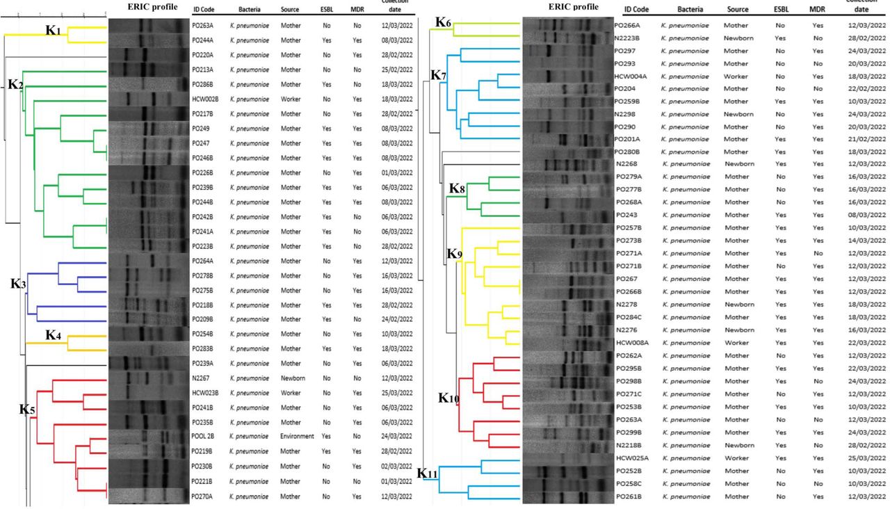 Genotypic relationship of K. pneumoniae isolates (n = 71) detected from mothers, neonates, healthcare workers and the environment. Dendogram generated by GelJ using UPGMA method and the Dice similarity coefficient.