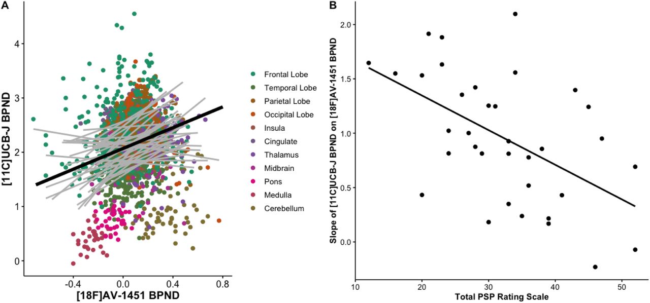 The association between synaptic density ([11C]UCB-J) and molecular pathology ([18F]AV- 1451) is a function of disease severity.A) Scatter plot of [11C]UCB-J BPND and [18F]AV-1451 BPND from 35 patients with PSP-Richardson’s syndrome and amyloid-negative CBD (each grey line represents a patient), across 73 regions of interest (excluding those with previously reported off-target binding, i.e. basal ganglia and substantia nigra); the dark black line in A depicts the overall fit of the linear mixed model, whilst grey lines represent individual patient participants. B) The slope for each individual (i.e. each grey line in A) is negatively correlated with disease severity (as measured with the PSP rating scale); R= -0.53, p<0.002.