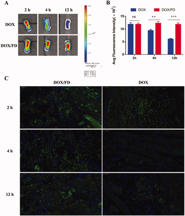 In vivo inflammation-targeting ability of fucoidan–deoxycholic acid (FD) nanomicelles after in situ dripping. (A) Fluorescence images of the tongue were obtained using an in vivo imaging spectrum system. (B) Semi-quantitative analysis of fluorescence images (n = 3). Data are shown as mean ± SD. (C) Immunofluorescence images of tongues after administration of DOX/FD nanomicelles (blue, nucleus; green, DOX/FD nanomicelles; purple, blood vessels). DOX: doxorubicin. Scale bar, 50 μm.