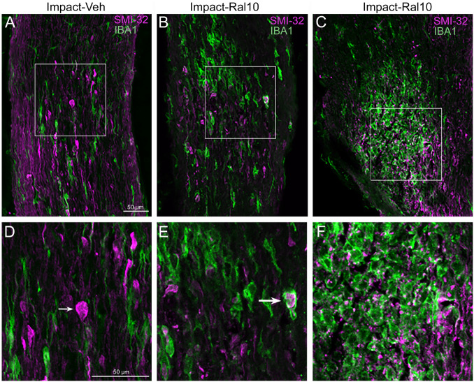 Axon injury and microglial activation in the optic nerve. Confocal images of optic nerve sections from mice 3 days after impact TBI, taken from the region just beyond the extraocular muscle cone, immunostained with SMI-32 to detect injured axons and for IBA1 to reveal microglia. (A) Large SMI-32+ axon bulbs (magenta) and intensely stained microglia (green), indicative of injury to the nerve, are visible in the image from an impact-vehicle mouse. Note that, by contrast, in sham mice, axon bulb pathology is absent (and thus not shown here) and microglia are lightly labeled for IBA1 (see Figure 7A). (B) Microglia with more rounded shapes are present in impact mice treated with 10 mg/kg raloxifene, one of which appears to be engulfing an axon bulb. (C) Numerous microglia are seen clustered together, amidst a field of small SMI-32+ profiles that resemble debris from degenerating axons. (D–F) Higher-magnification views of the regions shown boxed in (C). The small arrow in (D) marks an especially large axon bulb. The larger arrow in (E) indicates a rounded microglial cell that appears to be engulfing an axon bulb. Scale bar in (A) applies to (A–C), and scale bar in (D) applies to (D–F).