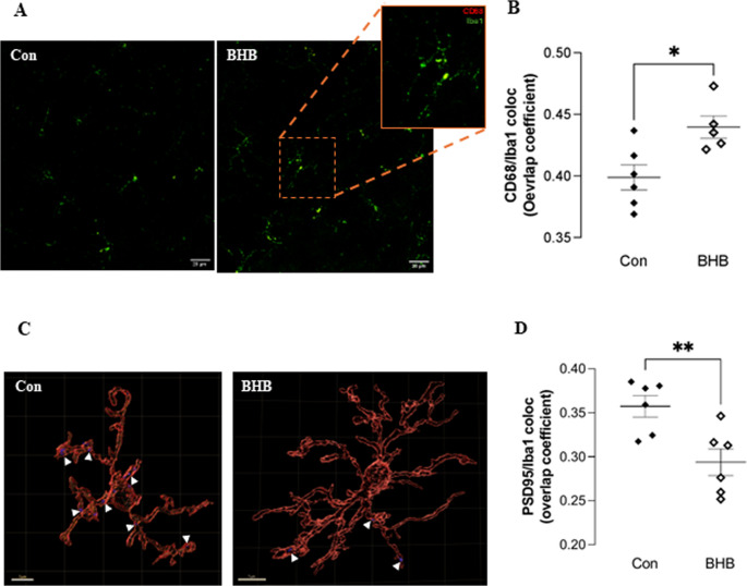 BHB treatment increases microglial phagocytic capacity while reduce synaptic pruning in the hippocampus of Obese mice (A) Representative confocal image showing CD68/Iba-1 colocalization in the hippocampus; (B) Quantification of CD68/Iba-1 overlap coefficient, showing increased colocalization in BHB-treated mice; (C) Representative IMARIS 3D reconstruction image showing PSD95 localization in microglia; (D) Quantification of PSD95/Iba-1 overlap coefficient, showing decreased colocalization in BHB-treated mice. Con – control group, BHB – BHB treatment group. n = 6. For each animal, 10–15 microglial cells were analyzed. Data are presented as mean ± SEM; *p < 0.05; **p < 0.01