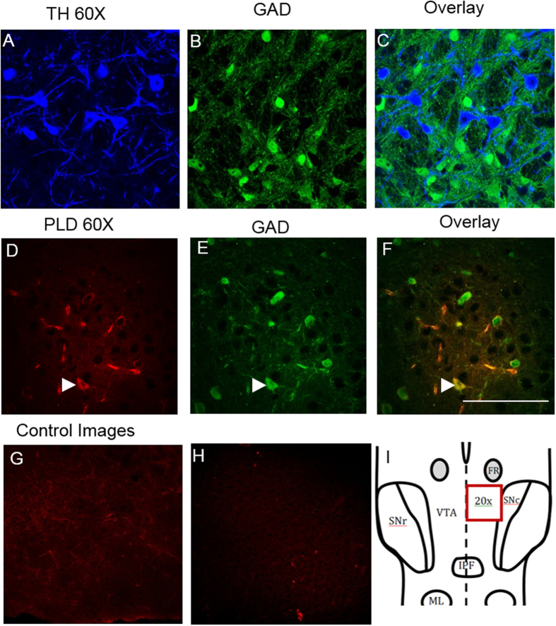 Immunolabeling of NAPE-PLD within mouse ventral tegmental area horizontal slices.TH immunoreactivity is distinct from GAD67-GFP positive neurons, demonstrating that identification of VTA neurons by these targets firmly establishes neuronal identity. Cytoplasmic protein expression of NAPE-PLD was noted clearly within many, but not all, GAD67-GFP VTA neurons. (A–C) TH and GAD67-GFP at 60× magnification demonstrate distinct VTA dopamine and GABA cells populations. Note that some non-labeled cells (non-TH/GAD67) noted were not quantified. (D–F) NAPE-PLD immunoreactivity at 60× magnification. Arrowheads identify positive immunolabeling of NAPE-PLD in GFP-positive GABA neurons. Scale bars: 100 μm. (G) Control image showing secondary antibody staining only. (H) Control image with preabsorption using a blocking peptide for DAGLα. Preabsorption and secondary antibody-only staining was done for NAPE-PLD and mGluR5 as well, with similar results (data not shown). (I) A schematic diagram of VTA showing area imaged in immunohistochemical experiments.
