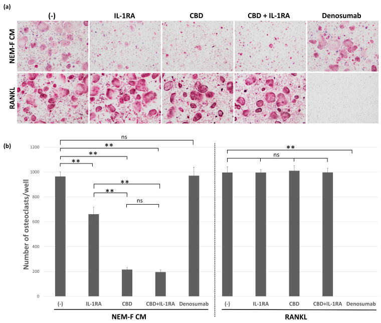The effects of IL-1RA and CBD on osteoclastogenesis induced by the culture supernatant of NEM-F cells and RANKL. (a) Evaluation of IL-1RA, CBD, and denosumab on osteoclastogenesis induced by the culture supernatant of NEM-F cells and RANKL. Representative views of TRAP staining after 5 days of culture. (b) The number of osteoclasts induced by the culture supernatant of NEM-F cells and RANKL, with or without treatment of IL-1RA, CBD, and denosumab. ** p < 0.01, ns: not significant (one-way ANOVA with the Tukey–Kramer method).