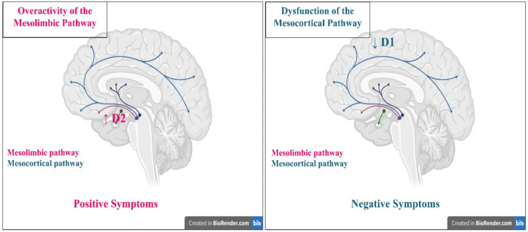 Dopamine hypothesis of schizophrenia pathogenesis (created in https://BioRender.com)