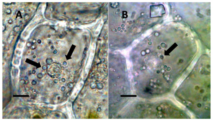 Vanilla phaeantha showing bacteria within and emerging from (arrows) nuclei. (A) Nucleus stained with acidified diphenylamine to show nitrate (blue-purple color) (Bar = 10 µm). (B) Nucleus stained with nitro blue tetrazolium to show superoxide (blue color) around bacteria (arrows) emerging from nucleus into cytoplasm (Bar = 10 µm).
