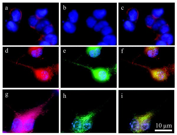 BV-2 microglia and HEK293-GPR18 transfected, but not HEK293 wildtype, cells express GPR18. Immunofluorescent confocal microscopy was conducted using an antibody against the GPR18 C-terminus (1:150; green), phalloidin to label actin (1:40; red), and DAPI (1.5 μg/ml) to label the nucleus (blue). a, HEK293 wildtype with DAPI and phalloidin. b, HEK293 wildtype with GPR18 antibody and phalloidin. c, HEK293 wildtype with GPR18 antibody, DAPI, and phalloidin. d, HEK293-GPR18 transfected with DAPI and phalloidin. e, HEK293-GPR18 transfected with GPR18 antibody and phalloidin. f, HEK293-GPR18 transfected with GPR18 antibody, DAPI, and phalloidin. g, BV-2 microglia with DAPI and phalloidin. h, BV-2 microglia with GPR18 antibody and phalloidin. i, BV-2 microglia with GPR18 antibody, DAPI, and phalloidin.
