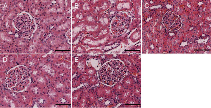 CIH causes renal damage. Changes in renal tissue morphology in each group were observed by HE staining. a: NC; b: 4w CIH; c: 6w CIH; d: 4w CIH + Ri; e: 6w CIH + Ri. Original magnification, × 200. Scale bars, 50 μm