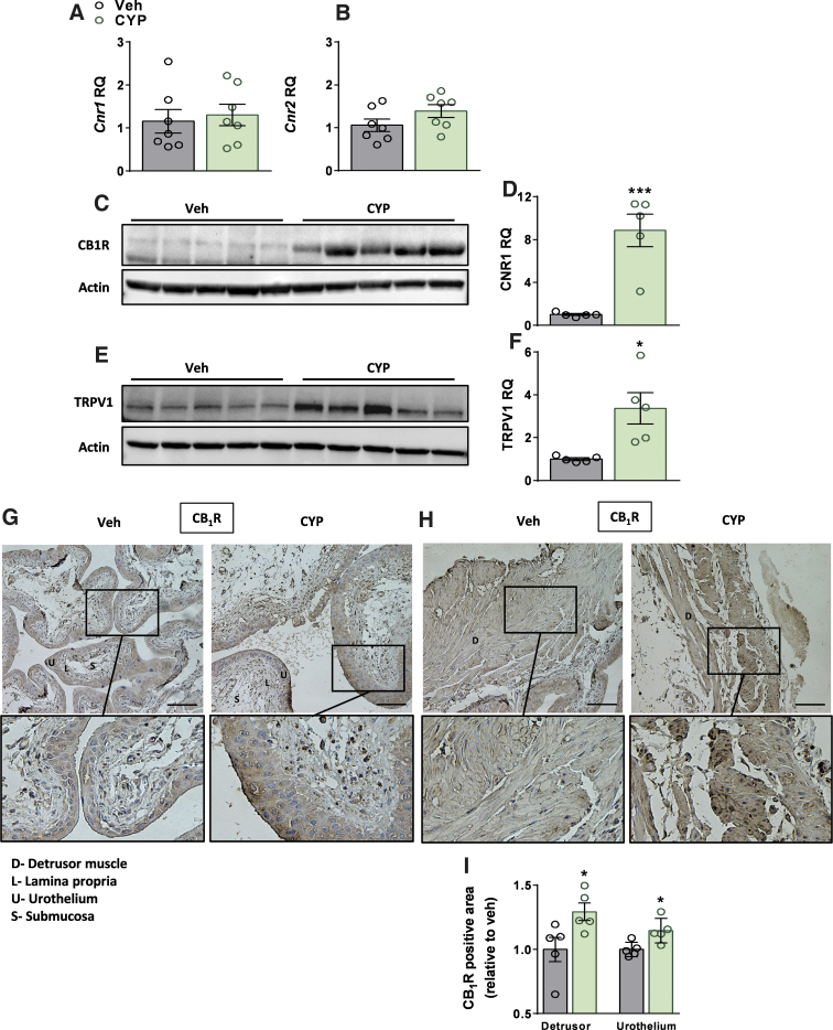CYP-induced cystitis upregulates CB1R and TRPV1 expression. No significant changes in the bladder mRNA expression levels of Cnr1 or Cnr2 in CYP-injected mice (A, B). Significant elevation in the bladder protein expression levels of CB1R (C, D) and TRPV1 (E, F). Representative immunohistochemical staining of CB1R in the bladder's urothelial cells (G) and detrusor muscle (H) and quantification of CB1R-positive areas in these cells (I) for each group, magnification×40, scale bar—50 μm. Data represent the mean±SEM. For (A, B), n=7 mice per group, and for (D, F, I), n=5 mice per group. *p<0.05 and ***p<0.001. CB1R, cannabinoid-1 receptor; TRPV1, transient receptor potential cation channel subfamily V member 1.