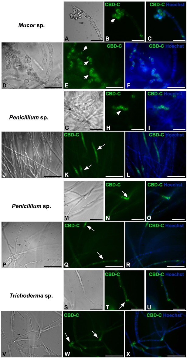 Immunofluorescence with the Fc-CBD-C probe on whole fungi grown in liquid medium. Fungal species, Mucor sp. (A–F), Penicillium spp. (G–R), and Trichoderma sp. (S–X), were grown in liquid medium and characterized by immunofluorescent staining with the Fc-CBD-C probe. In Mucor sp., CBD-C binds fungal spores (B,E, arrowheads); in Penicillium spp., CBD-C recognizes chitin in specific regions of the hyphae (K,N,Q, arrows) and in some cases fungal spores (H, arrowhead); in Trichoderma sp., chitin fibers are apparent in specific regions of the hyphae (T,W, arrows). (A,D,G,J,M,P,S,V) represent brightfield images; (C,F,I,L,O,R,U,X) represents merged images of the Fc-CBD-C probe (green) and nuclear staining with Hoechst (blue). Scale bars: (A–C,D–F,J–L,P–R,V–X), 50 μm; (G–I,M–O,S–U), 25 μm.
