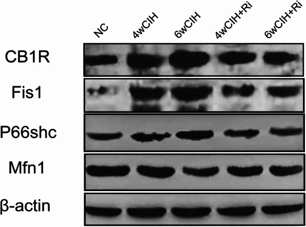 Representative western blotting images of CB1R, Fis1, p66shc and Mfn1 in renal tissue. Full-length blots are presented in Supplementary Figs. [1, 2, 3, 4, 5]