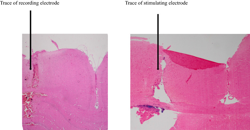 Exemplary photomicrograph illustrating places of stimulating and recording electrodes in a hippocampus section. Stimulating and recording electrode traces can be seen at the right and left sides, respectively. Scale bar: 0.5 mm