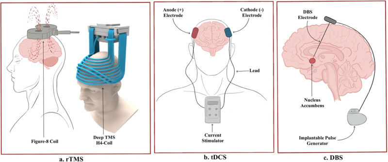 Neuromodulation techniques.Diagrams to illustrate the three neuromodulation techniques investigated: (a) rTMS (Deep TMS image acquired from Brainsway, Inc.), (b) tDCS, (c) DBS.