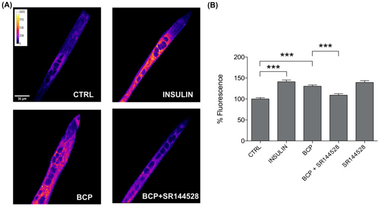 BCP enhances glucose uptake by CB2 receptor stimulation. (A) Representative confocal images of C2C12 incubated with the fluorescent glucose analog (2-NBDG) for 30 min in the dark. Images are presented in pseudocolor (LUT = fire) to better show the fluorescent intensity variations in the range 0–1031. Insulin was used as a positive control. Scale bar: 36 μm. (B) Bar graph summarizing glucose uptake experiments. CTRL: 100.00 ± 3.15, n cells = 66; Insulin: 141.06 ± 4.17, n cells = 60; BCP: 130.30 ± 3.16, n cells = 67; BCP + SR144528: 109.04 ± 3.64, n cells = 65; SR144528: 139.45 ± 4.26, n cells = 44. Data are represented as mean ± SEM (n = 4 independent experiments). *** p < 0.001.