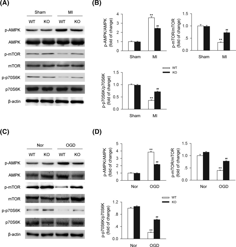 AMPK-mTOR-p70S6K signaling pathway is involved in the process of CB2R-mediated autophagy(A) Left anterior descending coronary artery was permanently occluded to create MI mice model. Heart issues were isolated at 24-h postinfarction. Levels of AMPK-mTOR-p70S6K signaling-related proteins were detected by western blot. (B) Quantitative analysis of the relative p-AMPK/AMPK, p-mTOR/mTOR, and p-p70S6K/p70S6K ratio (n=five per group). **P<0.01 versus WT sham; ##P<0.01 versus WT MI. (C) Primary cardiomyocytes isolated from WT or CB2R KO mice were exposed to OGD for 6 h. Levels of AMPK-mTOR-p70S6K signaling-related proteins were detected by western blot. (D) Quantitative analysis of the relative p-AMPK/AMPK, p-mTOR/mTOR, and p-p70S6K/p70S6K ratio (n=five per group). **P<0.01 versus WT nor; ##P<0.01 versus WT OGD.Nor, normal.