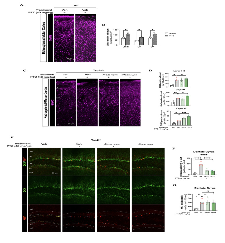A Fluorescent immunohistochemistry on coronal sections of WT mice (N = 5) for GluR2 was performed to visualize the GluR2-positive cells in response to the PTZ injection. B Quantitative analysis was performed to determine GluR2-positive cells in cortical layers (II-III, V, and VI). C Fluorescent immunohistochemistry of Tsc2+/– mice with different treatments (Vehicle, J4 (0.02 mg/ml), and J4 (0.06 mg/ml) for GluR2 was performed to visualize the GluR2-positive cells for each group (N = 4) in response to the PTZ injection. D Quantitative analysis was performed to determine GluR2-positive cells in cortical layers (II-III, V, and VI) for each group. E Fluorescent immunohistochemistry of DCX (green), co-labeled with Ki67 (red), of the hippocampal dentate gyrus of each group was performed. Quantitative results of immunoreactivity of DCX F and Ki67-positive cells G are shown. Data presented as mean ± SEM, *p < 0.05, ** p < 0.01, ***p < 0.001, ****p < 0.0001, n.s. not significant using unpaired T test and one-way ANOVA, with Bonferroni correction as the post-hoc test for multiple comparisons. Abbreviations: DCX, doublecortin