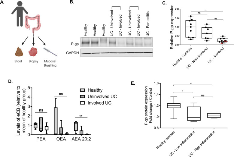 Human UC intestinal contents are unable to maintain P-gp expression. A Diagram of human sample collection (BioRender). B Representative western blot of P-gp expression in human patient colon biopsies, showing healthy control versus UC patient, and uninvolved versus involved tissue, with samples from same UC patients indicated with brackets. C Densitometry data of B, N = 7–9 patients per group, red squares indicate 3 pan-colitis patients; **p = 0.0012, one-way ANOVA with Tukey’s multiple comparisons test. D Palmitoyl ethanolamide (PEA), oleoyl ethanolamide (OEA), and anandamide (AEA) 20:2 measured in mucosal brushings of human patients. N = 4 healthy controls, N = 7–8 UC patients. **p = 0.0013, one-way ANOVA with Tukey’s multiple comparisons test. E Functional P-gp expression induced by human patient fecal samples in T84 cells in vitro. Data are normalized to representative vehicle control bowel prep solution; N = 5–11 patients per group; *p < 0.05, one-way ANOVA with Tukey’s multiple comparisons