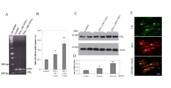 Cannabinoid receptor CB2 is expressed by cultured microglial cells. A, RT-PCR analysis of murine primary cultured microglial cells. A 239-bp band corresponding to CB2 was specifically generated with primers described in the Materials and methods section. B, Graphical representation of RT-PCR band density ratio of CB2 expression normalized to β-actin (mean +/- SD) is shown (n = 3 for each condition). ANOVA revealed significant between-group differences (control versus IFN-γ (50 U/mL) and IFN-γ (50 U/mL) versus IFN-γ (100 U/mL); p < 0.005). C, Western immunoblot analysis of murine primary cultured microglial cells using specific antibodies targeting CB2 and β-actin proteins. D, Western blot band density is represented as ratio of CB2 to β-actin (mean +/- SD; n = 4 for each condition). ANOVA revealed significant between-group differences [Control versus IFN-γ (50 U/mL) and IFN-γ (50 U/mL) versus IFN-γ (100 U/mL); ** p < 0.005]. E, Cannabinoid receptor CB2 is expressed in microglial cells in situ. In white matter, microglial cells are positive in their somata and processes for CB2. White arrowheads show positive cells as indicated. The expression of CB2 (FITC; green) was co-localized with Iba-1, microglial cell marker (TRITC; red) as indicated. Bottom panel denotes merge signals. Bar denotes 10 μm.