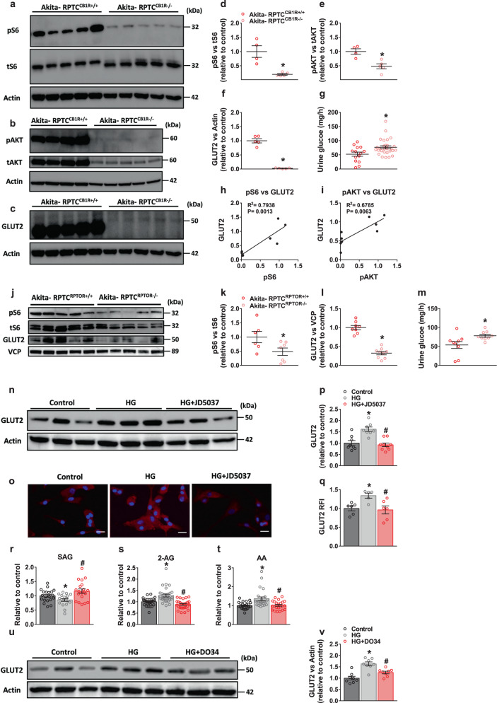 RPTC CB1R regulates mTORC1 and GLUT2.a, d Immunoblotting analysis and quantification of pS6 (S235/236) in kidney lysates from Akita-RPTCCB1R+/+ and Akita-RPTCCB1R−/− diabetic mice. n = 4 mice for Akita-RPTCCB1R+/+, n = 5 mice for Akita-RPTCCB1R−/− (*P = 0.0032). b, e Immunoblotting analysis and quantification of pAKT (S473) in kidney lysates from Akita-RPTCCB1R+/+ and Akita-RPTCCB1R−/− diabetic mice. n = 4 mice for Akita-RPTCCB1R+/+, n = 5 mice for Akita-RPTCCB1R−/− (*P = 0.0056). c, f Immunoblotting analysis and quantification of GLUT2 in kidney lysates from Akita-RPTCCB1R+/+ and Akita-RPTCCB1R−/− diabetic mice. n = 5 mice per group (*P < 0.0001). g Urinary glucose levels in diabetic mice. n = 14 mice for Akita-RPTCCB1R+/+, n = 28 mice for Akita-RPTCCB1R−/− (*P = 0.0123). h, i Correlation analysis between pS6 or pAKT and GLUT2 protein expression levels (h, P = 0.0013; i, P = 0.0063). j Representative immunoblots for pS6 and GLUT2 in kidney lysates from Akita-RPTCRPTOR+/+ and Akita-RPTCRPTOR−/− diabetic mice. n = 5 mice per group. k Immunoblotting analysis for pS6 in kidney lysates. n = 6 mice for Akita-RPTCRPTOR+/+, n = 7 mice for Akita-RPTCRPTOR−/− (*P = 0.0475). l Immunoblotting analysis for GLUT2 in kidney lysates. n = 8 mice for Akita-RPTCRPTOR+/+, n = 9 mice for Akita-RPTCRPTOR−/− (*P < 0.0001). m Urinary glucose levels in Akita-RPTCRPTOR+/+ and Akita-RPTCRPTOR−/− diabetic mice. n = 9 mice per group (*P = 0.0271). n, p Representative immunoblots of GLUT2 in hRPTCs treated with HG (30 mM) or HG + JD5037 (100 nM) for 24 h. n = 8 for Control and HG groups, n = 9 for HG + JD5037 (*P = 0.0010, #P < 0.0001). o, q Representative GLUT2 immunofluorescence staining of primary hRPTCs treated with HG (30 mM) or HG + JD5037 (100 nM) for 24 h and quantification. 10× magnification, scale bar: 100 µm. n = 6 for Control and HG + JD5037 groups, n = 5 for HG group (*P = 0.0049, #P = 0.0189). r LC-MS/MS quantification of SAG in primary hRPTCs treated with HG (30 mM) or HG + JD5037 (100 nM) for 1 h. n = 20 biological replicates for the control group, n = 17 for HG group, n = 20 for HG + JD group (*P = 0.0467, #P = 0.0025). s LC-MS/MS quantification of 2-AG in primary hRPTCs treated with HG (30 mM) or HG + JD5037 (100 nM) for 1 h. n = 31 for Control, n = 30 for HG group, n = 27 for HG + JD group (*P < 0.0001, #P < 0.0001). t LC-MS/MS quantification of AA in primary hRPTCs treated with HG (30 mM) or HG + JD5037 (100 nM) for 1 h. n = 24 for Control and HG groups, n = 23 for HG + JD group (*P = 0.0010, #P = 0.0026). u, v Representative immunoblots of GLUT2 in hRPTCs treated with HG (30 mM) or HG + DO34 (100 nM) for 24 h. n = 8 per group (*P < 0.0001, #P = 0.0025). Data represent the mean ± SEM and were analyzed by Unpaired Two-tailed Student’s t-test or one-way ANOVA followed by Tukey test (one-sided). In b–j *P < 0.05 relative to the corresponding Akita-RPTCCB1R+/+ or Akita-RPTCRPTOR+/+ control groups. In l–q *P < 0.05 relative to the corresponding control group. #P < 0.05 relative to the HG-treated group. Source data are provided as a Source Data file.